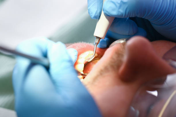 Best Emergency Treatment for Oral Infections in Paramus, NJ